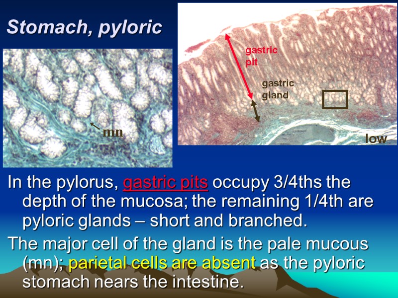 Stomach, pyloric In the pylorus, gastric pits occupy 3/4ths the depth of the mucosa;